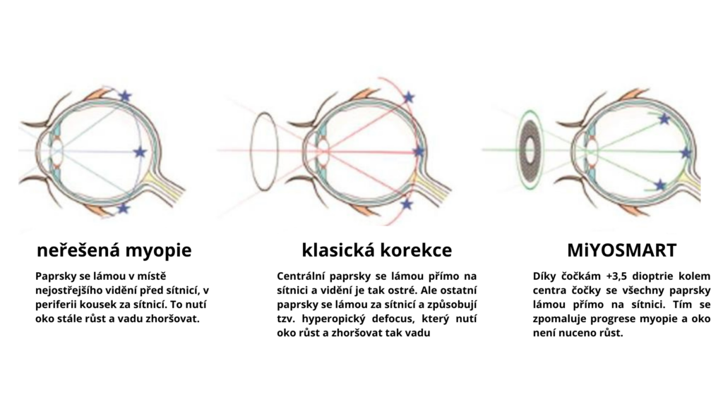 Funkce čočky MiYOSMART